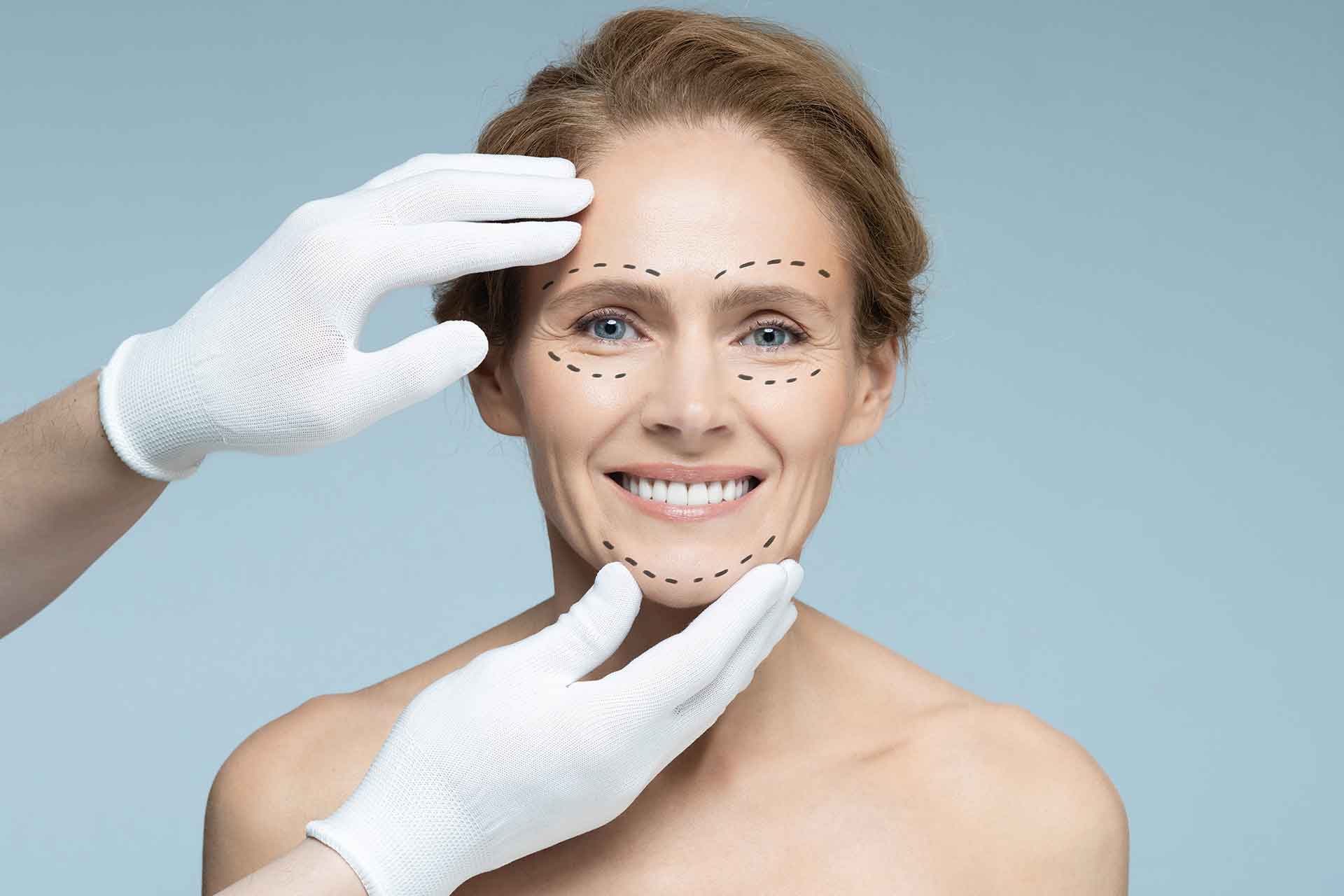 face-lift-surgery